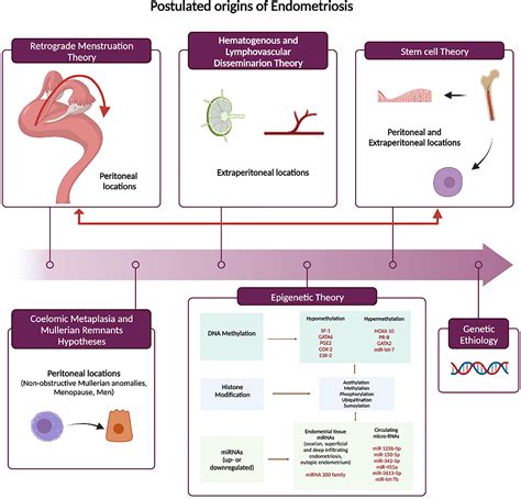 endometriosis treatment for infertility